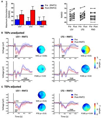 The Effect of <mark class="highlighted">Lamotrigine</mark> and Levetiracetam on TMS-Evoked EEG Responses Depends on Stimulation Intensity